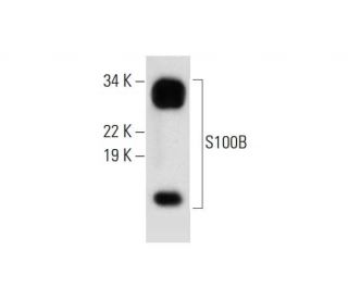 western blotting image from recommended S-100 &beta; chain (C-3) monoclonal antibody replacement. Image 299217