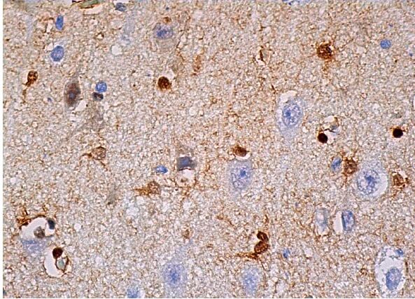 s-100-beta-chain-antibody-c-3-