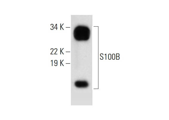 s-100-beta-chain-antibody-c-3-