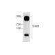 western blotting image from recommended S-100 β chain (C-3) monoclonal antibody replacement. Image 299217