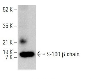 S-100 β chain Antibody (9A11B9) - Western Blotting - Image 378707