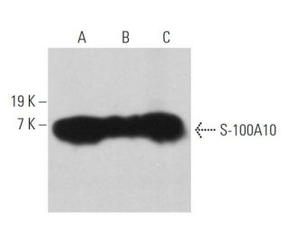 S-100A10 Antibody (4E7E10) - Western Blotting - Image 362355 