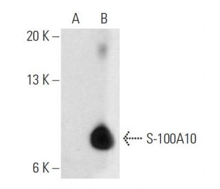 S-100A10 Antibody (4E7E10) - Western Blotting - Image 19296 