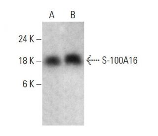 S-100A16 Antibody (G-7) - Western Blotting - Image 387986Each CRISPR/Cas9 Knockout (KO) Plasmid product consists of a pool of 3 plasmids designed to ensure identification and cleavage of a specific gene for maximum knockout efficiency. Each plasmid encodes a unique 20 nt sequence derived from the GeCKO (v2) library.