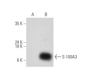 S-100A3 Antibody (A-11) - Western Blotting - Image 319920Each CRISPR/Cas9 Knockout (KO) Plasmid product consists of a pool of 3 plasmids designed to ensure identification and cleavage of a specific gene for maximum knockout efficiency. Each plasmid encodes a unique 20 nt sequence derived from the GeCKO (v2) library. 