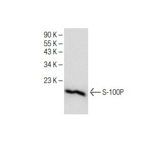 S-100P Antibody (B-10) - Western Blotting - Image 151210SAM Transcription Activation: SAM system utilizing dCas9-VP64, MS2-P65-HSF1, and sgRNA for precise gene transcription activation.