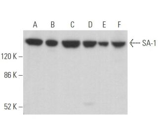 SA-1 Antibody (A-9) - Western Blotting - Image 372763Each CRISPR/Cas9 Knockout (KO) Plasmid product consists of a pool of 3 plasmids designed to ensure identification and cleavage of a specific gene for maximum knockout efficiency. Each plasmid encodes a unique 20 nt sequence derived from the GeCKO (v2) library.