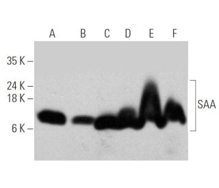 SAA Antibody (115) - Western Blotting - Image 368211