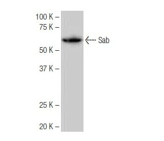 Sab Antibody (PL-A23) - Western Blotting - Image 65114 
