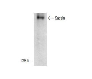 Sacsin Antibody (F-1) - Western Blotting - Image 142632 