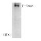 Sacsin Antibody (F-1) - Western Blotting - Image 142632 