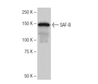 SAF-B Antibody (4D6) - Western Blotting - Image 65117 