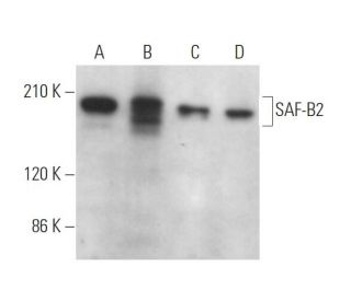 SAF-B2 Antibody (A-9) - Western Blotting - Image 371325 