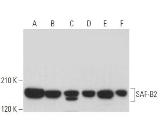 SAF-B2 Antibody (E-2) - Western Blotting - Image 371327 