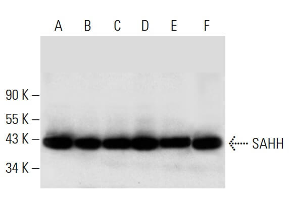 SAHH Antibody (A-11) | SCBT - Santa Cruz Biotechnology SAHH Antibody (A-11) | SCBT - Santa Cruz Biotechnology