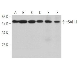 SAHH Antibody (F-11) - Western Blotting - Image 363876