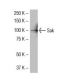 SAK/STK18/PLK4 Antibody (19-Y7) - Western Blotting - Image 33786