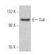 SAK/STK18/PLK4 Antibody (19-Y7) - Western Blotting - Image 367977 