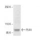 SAK/STK18/PLK4 Antibody (19-Y7) - Western Blotting - Image 404267 