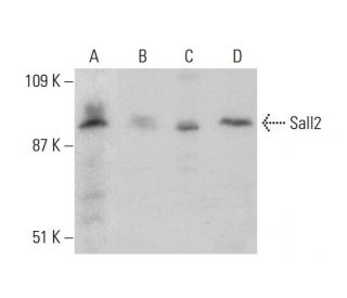 Sall2 Antibody (PL-A12) - Western Blotting - Image 384241 
