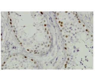 Sall4 Antibody (EE-30) - Immunohistochemistry - Image 36313 