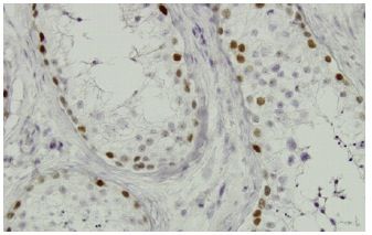 Sall4抗体(EE-30) | SCBT - Santa Cruz Biotechnology