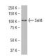 Sall4 Antibody (EE-30) - Western Blotting - Image 34507