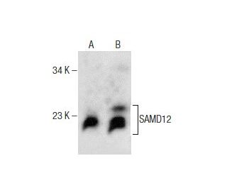 SAMD12 Antibody (A-6) - Western Blotting - Image 281791
