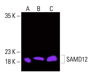 SAMD12 Antibody (A-6) - Western Blotting - Image 416183 