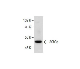 Nicotinic Acetylcholine Receptor epsilon/CHRNE Antibody (D-6) - Western Blotting - Image 159875 