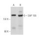 SAP 155 Antibody (G-9) - Western Blotting - Image 357988 