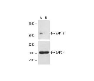 SAP 18 siRNA (h): sc-36454. Western blot analysis of SAP 18 expression in non-transfected control (A) and SAP 18 siRNA tra 