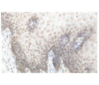 SAP 30 Antibody (CA14) - Immunohistochemistry - Image 53925