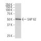 SAP 62 Antibody (32J-7) - Western Blotting - Image 34499 