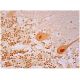 SAP 62 Antibody (4G8) - Immunohistochemistry - Image 296614