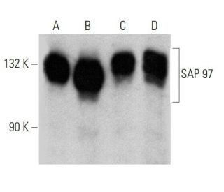 western blotting image from recommended SAP 97 (2D11) monoclonal antibody replacement. Image 356329