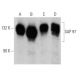 This polyclonal antibody has been discontinued. See our recommended <a href="sap-97-antibody-2d11">SAP 97 (2D11)</a> monoclonal antibody (sample data shown). western blotting image from recommended SAP 97 (2D11) monoclonal antibody replacement. Image 356329