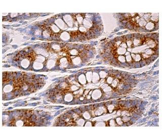 immunohistochemistry image from recommended saposin C (A-3) monoclonal antibody replacement. Image 159613