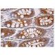 immunohistochemistry image from recommended saposin C (A-3) monoclonal antibody replacement. Image 159613