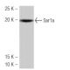 Sar1a Antibody (K-44) - Western Blotting - Image 53963 