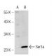 Sar1a Antibody (K-44) - Western Blotting - Image 125789