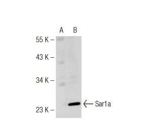 Sar1a Antibody (K-44) - Western Blotting - Image 125789Each CRISPR/Cas9 Knockout (KO) Plasmid product consists of a pool of 3 plasmids designed to ensure identification and cleavage of a specific gene for maximum knockout efficiency. Each plasmid encodes a unique 20 nt sequence derived from the GeCKO (v2) library. 