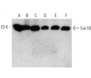 Sar1B Antibody (AT1C7) - Western Blotting - Image 385128SAM Transcription Activation: SAM system utilizing dCas9-VP64, MS2-P65-HSF1, and sgRNA for precise gene transcription activation.