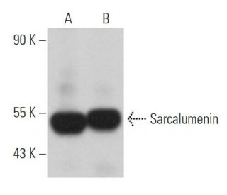 Sarcalumenin Antibody (XIIC4) - Western Blotting - Image 366256 