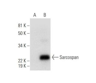 Sarcospan Antibody (E-2) - Western Blotting - Image 292958