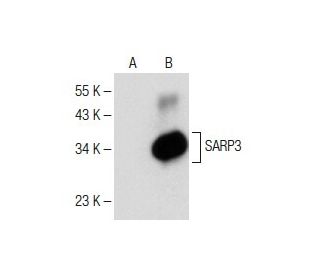 SARP3 Antibody (H-6) - Western Blotting - Image 150293SAM Transcription Activation: SAM system utilizing dCas9-VP64, MS2-P65-HSF1, and sgRNA for precise gene transcription activation.