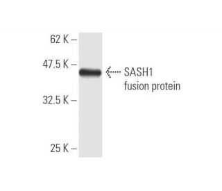SASH1 Antibody (X1) - Western Blotting - Image 349538