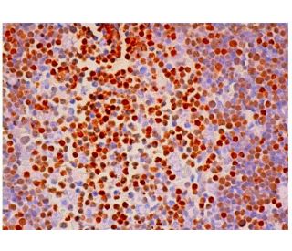 immunohistochemistry image from recommended SATB1 (C-6) monoclonal antibody replacement. Image 313916