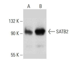 SATB2 Antibody (G-11) - Western Blotting - Image 385347 