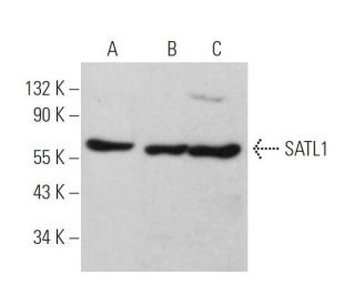 SATL1 Antibody (E-8) - Western Blotting - Image 371662 